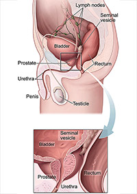Illustration of prostate.